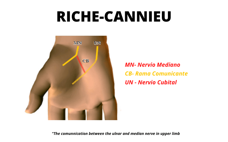 Riche Canneau.png